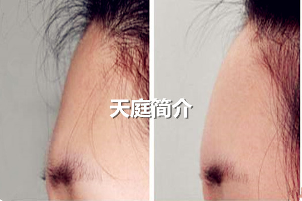 面相基础：天庭简介