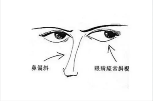 一生孤独的面相特征