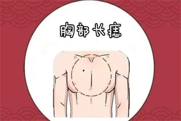 胸口有痣好吗，​长在哪里的痣是福痣