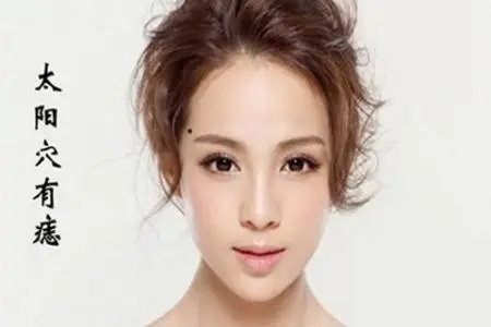 女性右侧太阳穴长痣好吗