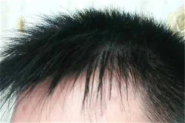 男人发型风水禁忌