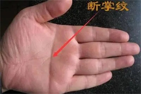​手掌中断掌的看法