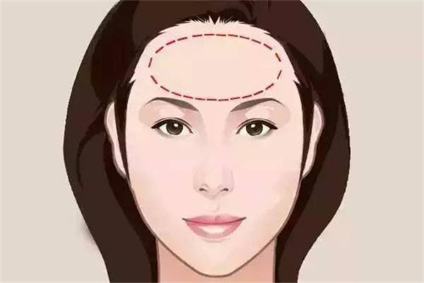 天庭饱满的女人的命运