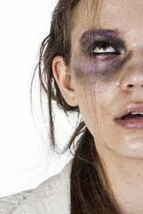 女人面部痣相技巧