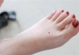 女人脚上长痣好吗