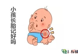 ​胎记的位置与命运详解，小孩长胎记好吗