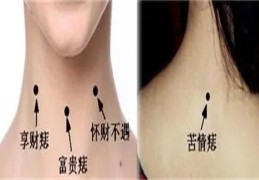 女人脖子左侧有痣好吗
