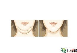 双下巴的女人是福相吗