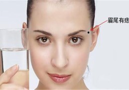 长在哪里的痣属于妨夫痣