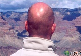 越来头发越少的八字特点