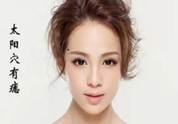 女性右侧太阳穴长痣好吗