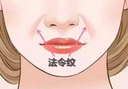 面相简介：法令纹相法