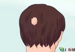 有疤的面相凶相解析