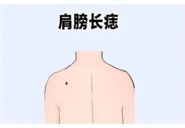 肩膀痣算命大全