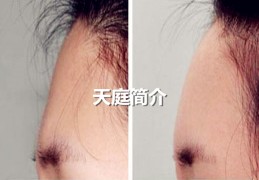 面相基础：天庭简介