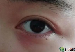 长在哪里的痣旺桃花