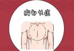 胸口有痣好吗，​长在哪里的痣是福痣