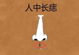 长在哪里的痣是苦命痣