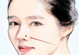 ​长苦情痣的人一定会离婚吗